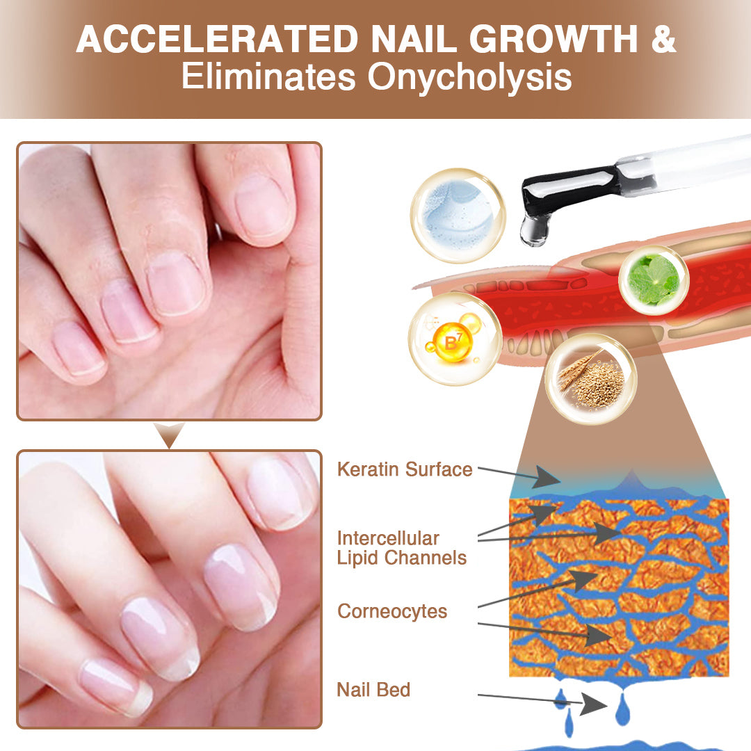 Onycholysis Heal Nail Strengthening And Growth Conditioner