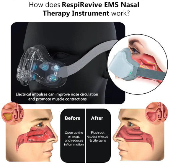 RespiRevive EMS Nasal Therapy Instrument