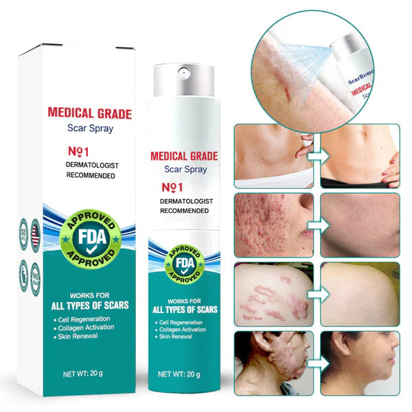 Advanced Scar Spray For All Types of Scars ❤️